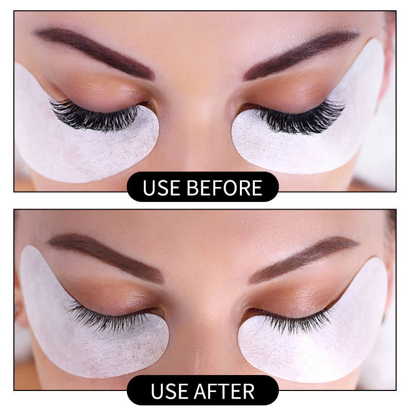 Removedor de cola para extensã - Eyelash Extension Eye Irritation avaliação e preço